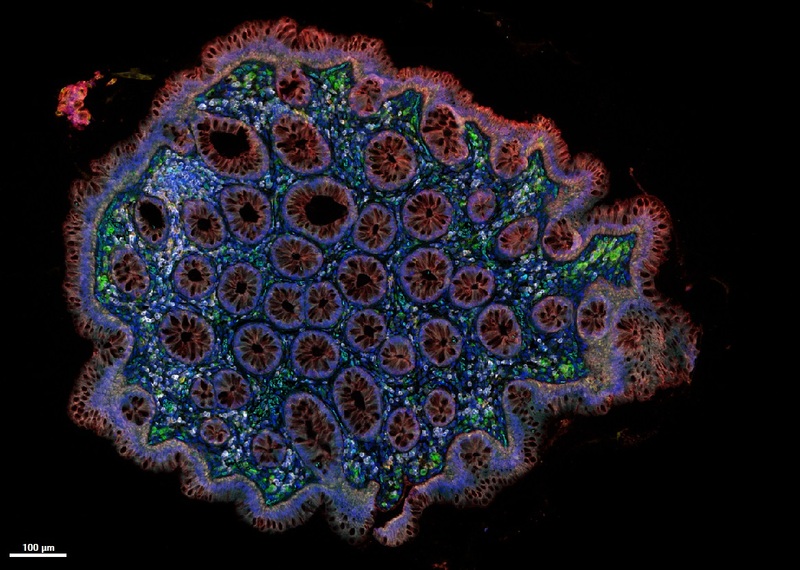 Scaled image Research_Objects/RO_37_Colon_multiplex_Mauro Esposito.jpg
