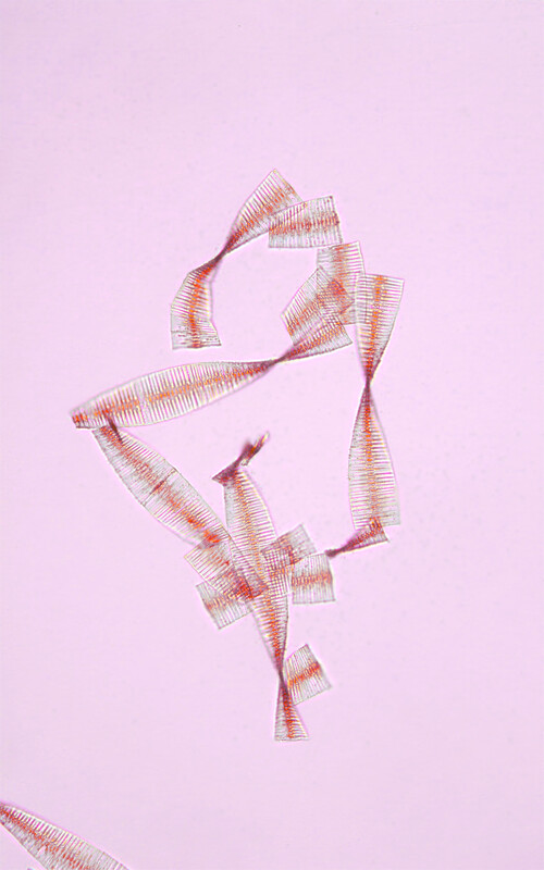 Scaled image Research_Objects/RO_4_1_Ryf_Divina_Red_Shapes_of_Fragilaria_crotone_Divina Ryf.jpeg